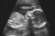 "We even name her baby and ask God to let him live and to let her see the truth because we know abortion not only kills the baby, but deeply wounds the mother�s soul."
